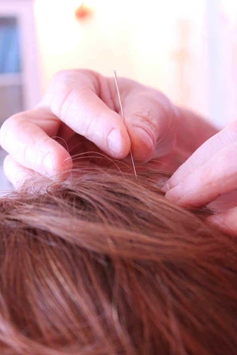 Micro-Needling Treatment