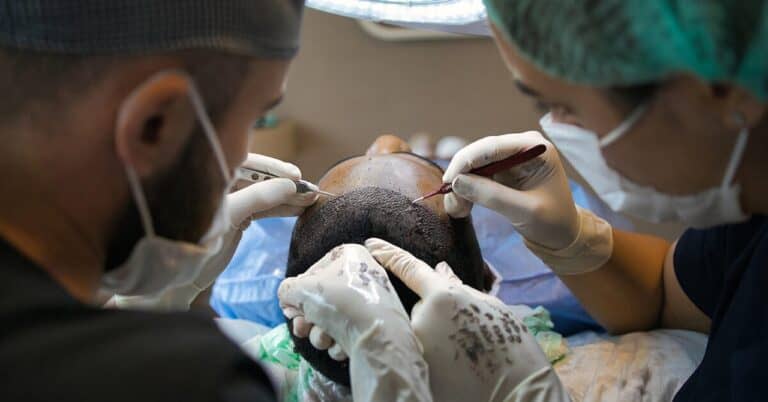 Micro-Needling Treatment